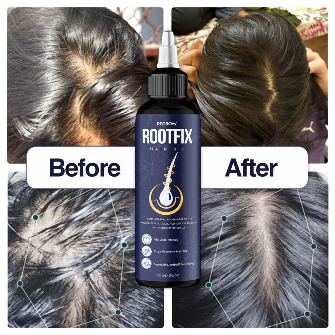 Clinically Proven ROOTFIX Hair Oil